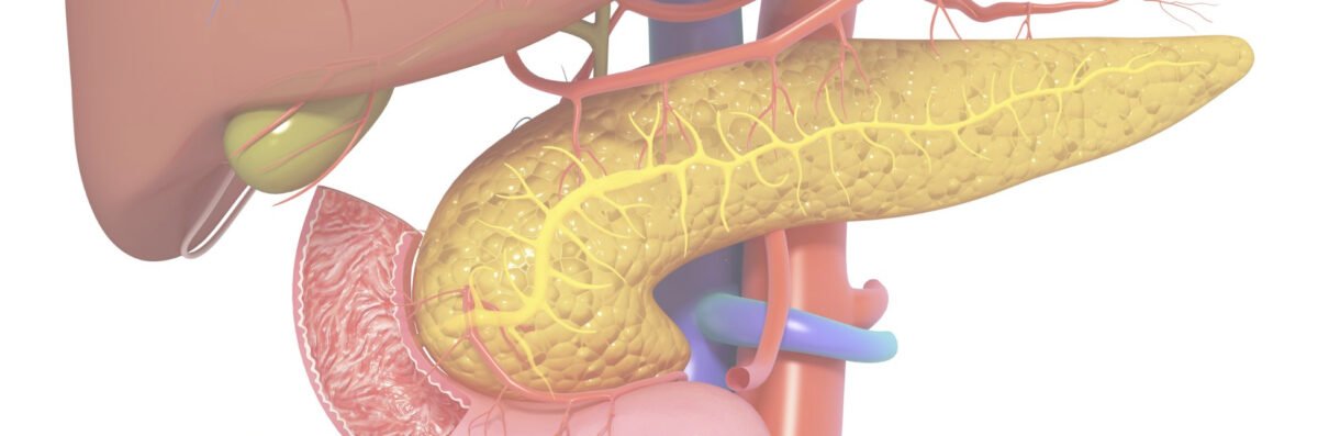 Tumores de Páncreas
